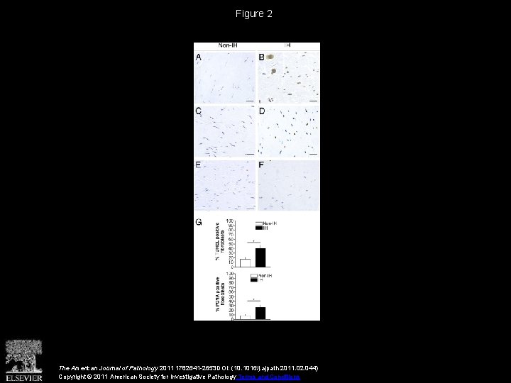 Figure 2 The American Journal of Pathology 2011 1782641 -2653 DOI: (10. 1016/j. ajpath.