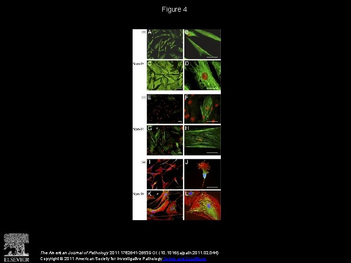 Figure 4 The American Journal of Pathology 2011 1782641 -2653 DOI: (10. 1016/j. ajpath.