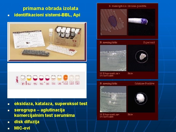 primarna obrada izolata n n n identifikacioni sistemi-BBL, Api oksidaza, katalaza, superoksol test serogrupa