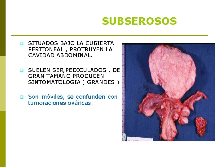 SUBSEROSOS q SITUADOS BAJO LA CUBIERTA PERITONEAL , PROTRUYEN LA CAVIDAD ABDOMINAL. q SUELEN