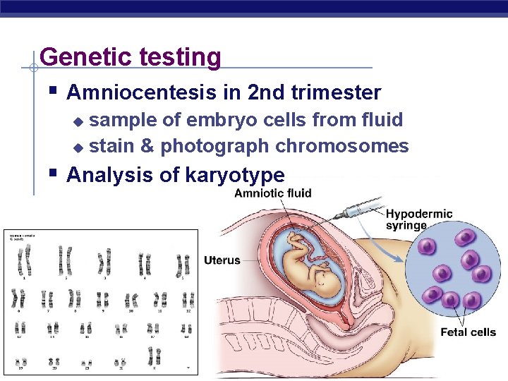 Genetic testing § Amniocentesis in 2 nd trimester sample of embryo cells from fluid