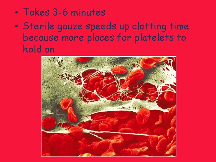  • Takes 3 -6 minutes • Sterile gauze speeds up clotting time because