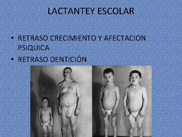 LACTANTEY ESCOLAR • RETRASO CRECIMIENTO Y AFECTACION PSIQUICA • RETRASO DENTICIÓN 