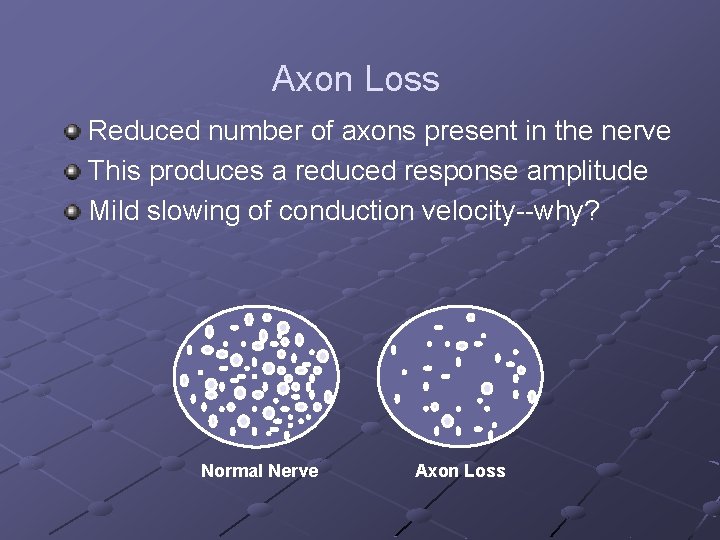 Axon Loss Reduced number of axons present in the nerve This produces a reduced