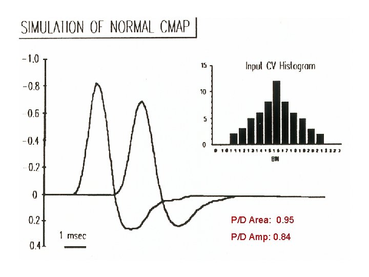 P/D Area: 0. 95 P/D Amp: 0. 84 