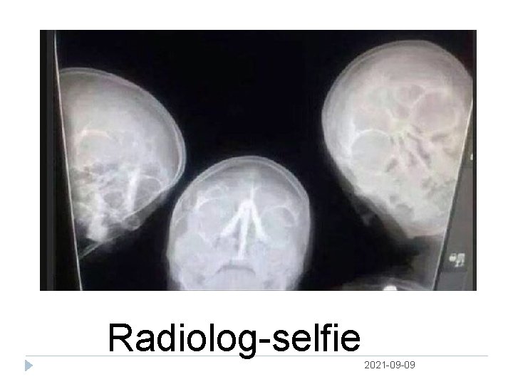 Radiolog selfie 2021 09 09 
