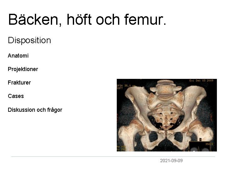 Bäcken, höft och femur. Disposition Anatomi Projektioner Frakturer Cases Diskussion och frågor 2021 09