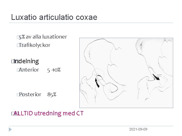 Luxatio articulatio coxae � 5% � av alla luxationer �Traﬁkolyckor � � Indelning �