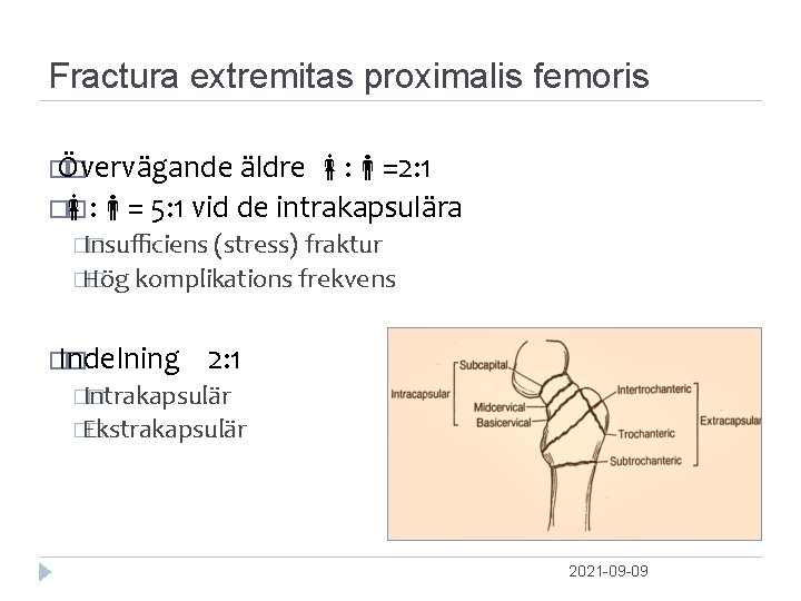 Fractura extremitas proximalis femoris � Övervägande � äldre : =2: 1 � : =