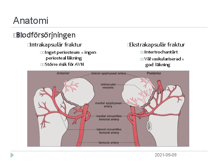 Anatomi � Blodförsörjningen � �Intrakapsulär � fraktur Inget periosteum = ingen periosteal läkning Större