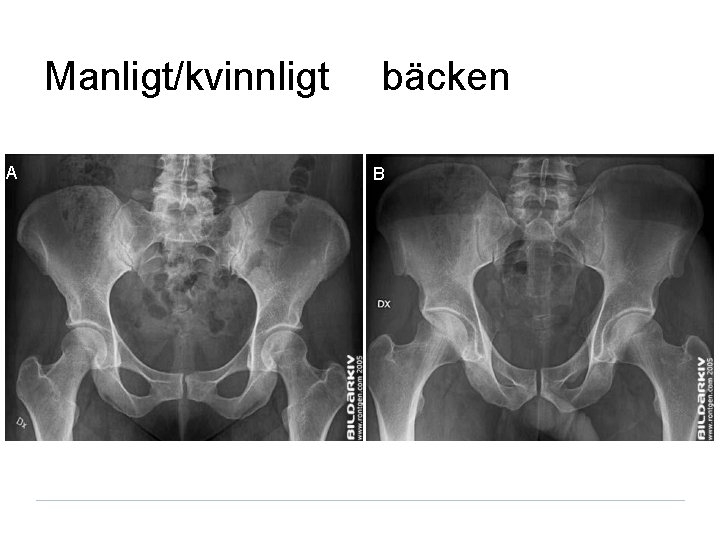 Manligt/kvinnligt A bäcken B 