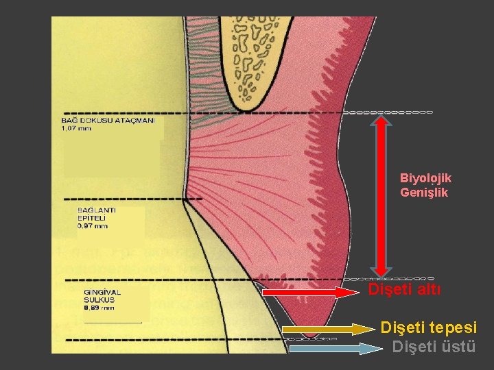 Biyolojik Genişlik Dişeti altı Dişeti tepesi Dişeti üstü 