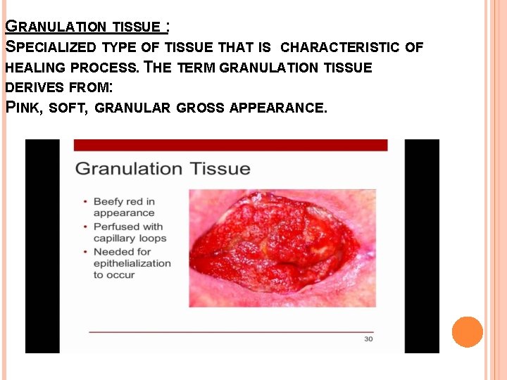 GRANULATION TISSUE : SPECIALIZED TYPE OF TISSUE THAT IS CHARACTERISTIC OF HEALING PROCESS. THE