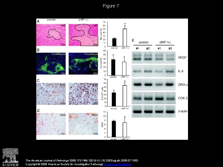 Figure 7 The American Journal of Pathology 2008 1731186 -1201 DOI: (10. 2353/ajpath. 2008.