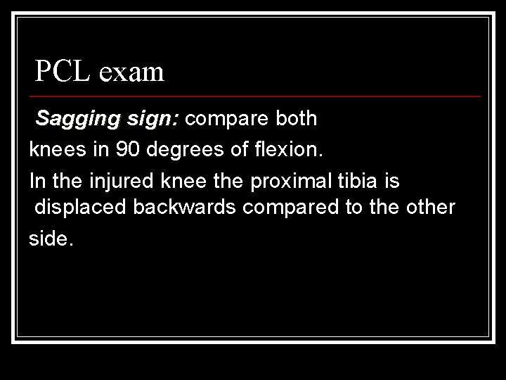 PCL exam Sagging sign: compare both knees in 90 degrees of flexion. In the
