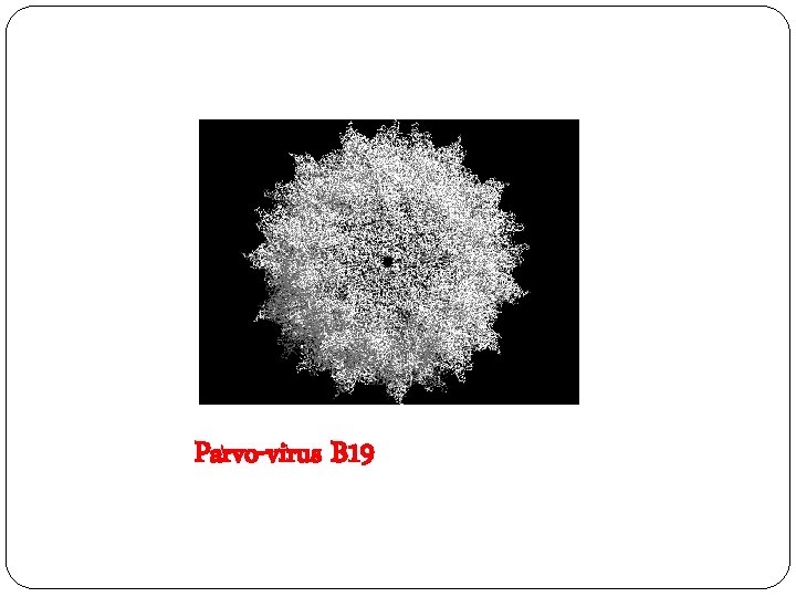 Parvo-virus B 19 