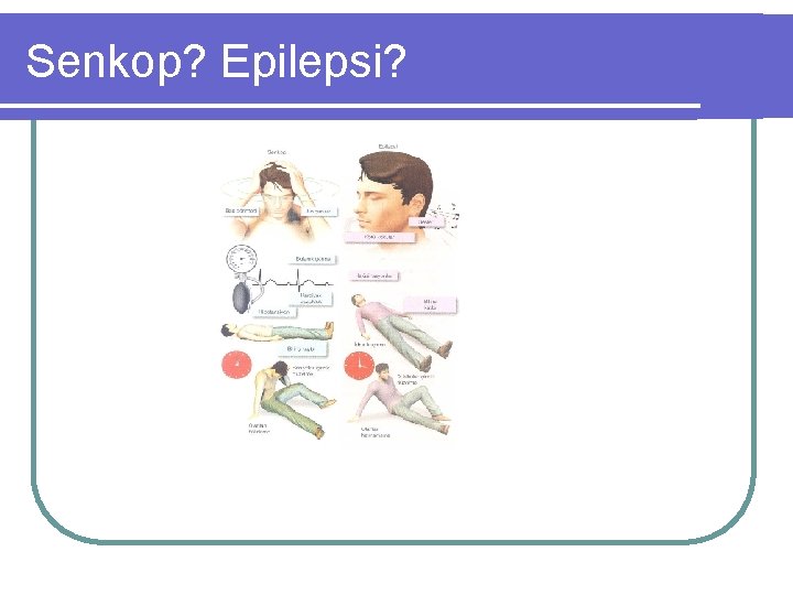 Senkop? Epilepsi? 