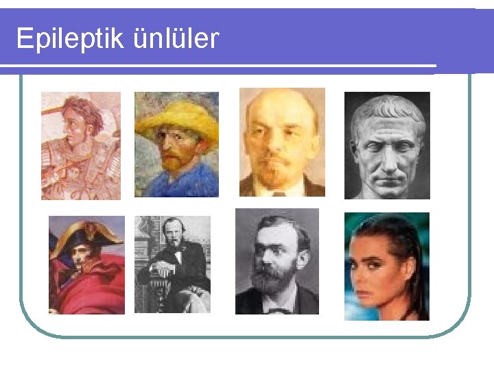 Epileptik ünlüler 