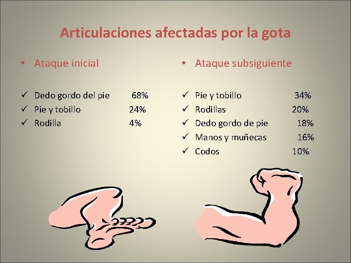 Articulaciones afectadas por la gota • Ataque inicial ü Dedo gordo del pie ü