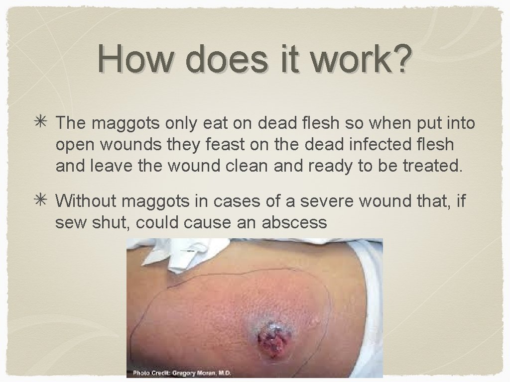 How does it work? The maggots only eat on dead flesh so when put
