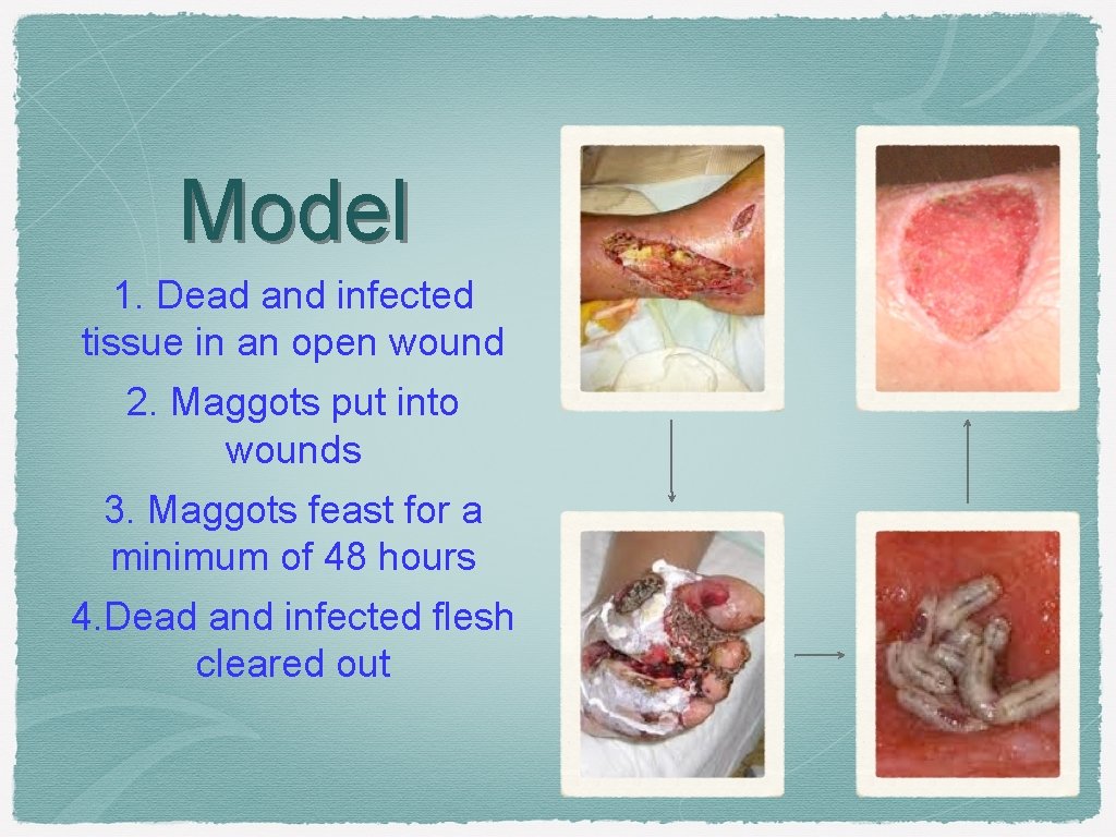 Model 1. Dead and infected tissue in an open wound 2. Maggots put into