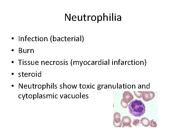 Neutrophilia • • • Infection (bacterial) Burn Tissue necrosis (myocardial infarction) steroid Neutrophils show