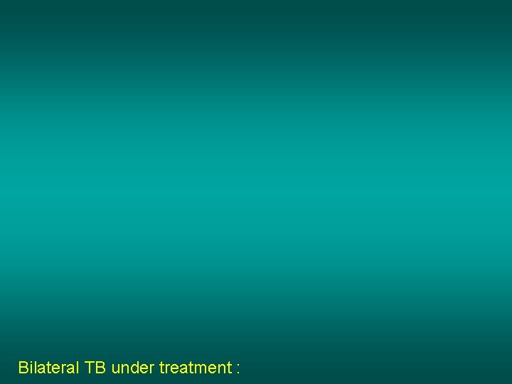 Bilateral TB under treatment : 