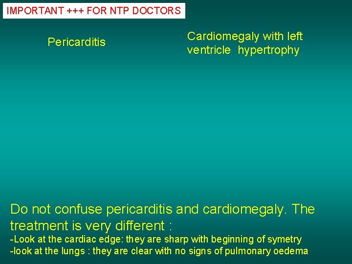 IMPORTANT +++ FOR NTP DOCTORS Pericarditis Cardiomegaly with left ventricle hypertrophy Do not confuse