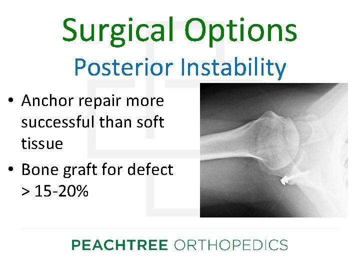 Surgical Options Posterior Instability • Anchor repair more successful than soft tissue • Bone