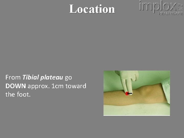 Location From Tibial plateau go DOWN approx. 1 cm toward the foot. 