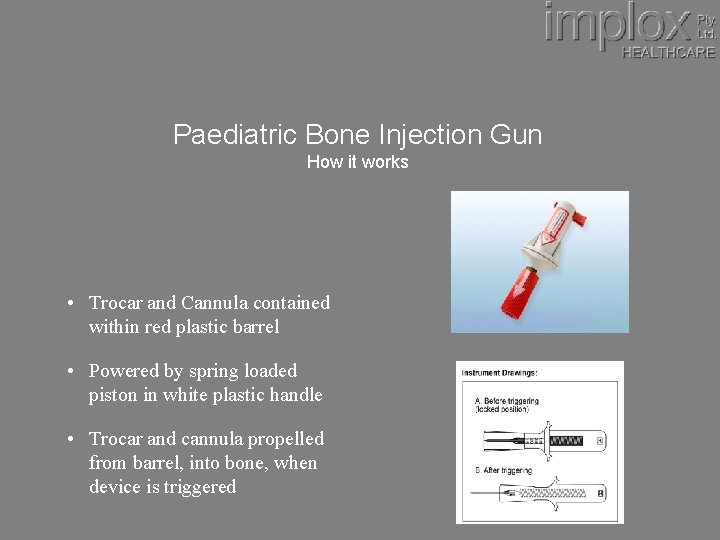 Paediatric Bone Injection Gun How it works • Trocar and Cannula contained within red