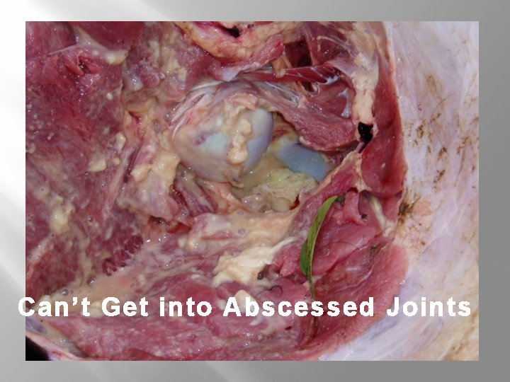 Can’t Get into Abscessed Joints 