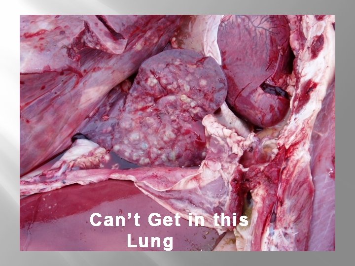 Can’t Get in this Lung 