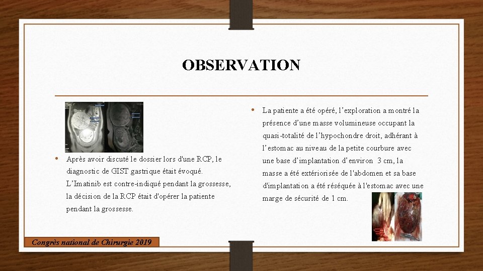 OBSERVATION • La patiente a été opéré, l’exploration a montré la présence d’une masse