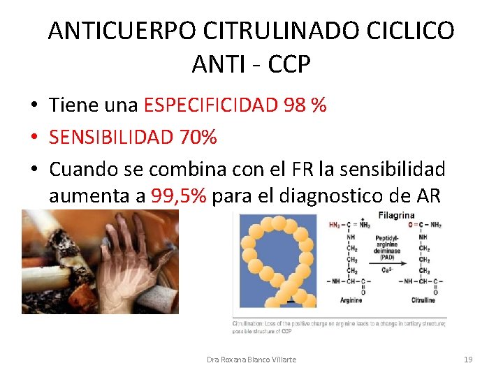 ANTICUERPO CITRULINADO CICLICO ANTI - CCP • Tiene una ESPECIFICIDAD 98 % • SENSIBILIDAD