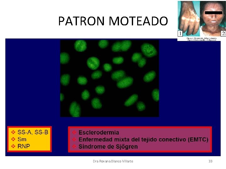 PATRON MOTEADO Dra Roxana Blanco Villarte 33 