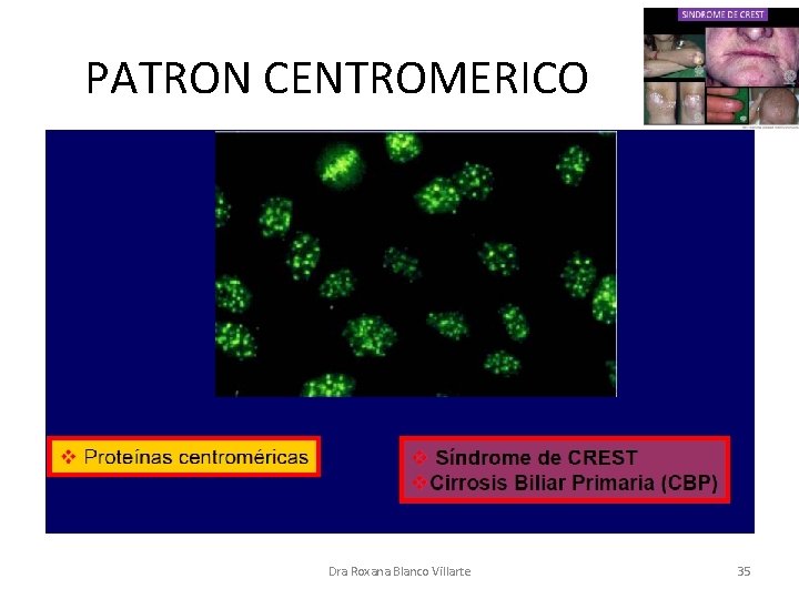 PATRON CENTROMERICO Dra Roxana Blanco Villarte 35 