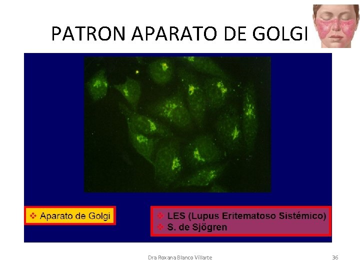 PATRON APARATO DE GOLGI Dra Roxana Blanco Villarte 36 