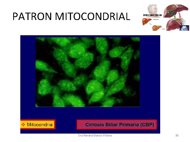 PATRON MITOCONDRIAL Dra Roxana Blanco Villarte 38 