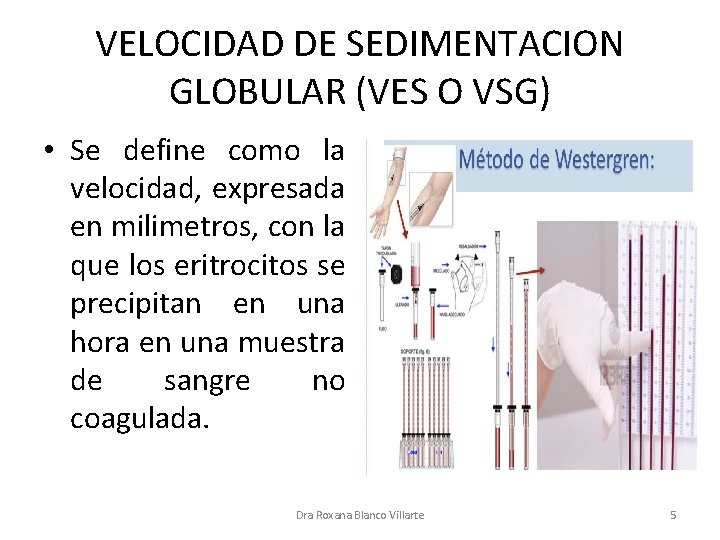 VELOCIDAD DE SEDIMENTACION GLOBULAR (VES O VSG) • Se define como la velocidad, expresada