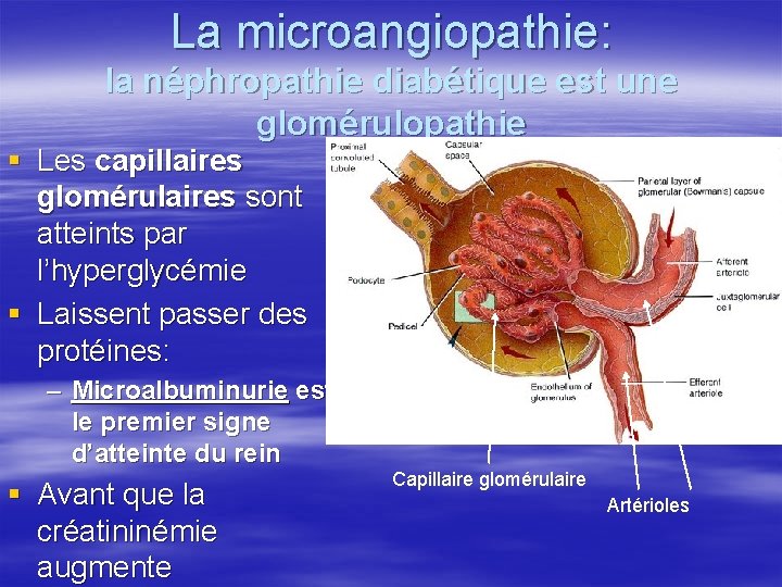 La microangiopathie: la néphropathie diabétique est une glomérulopathie § Les capillaires glomérulaires sont atteints