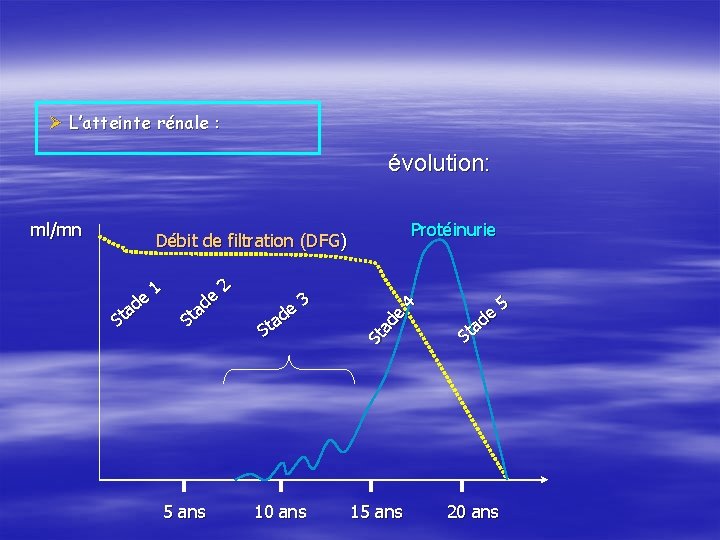 Ø L’atteinte rénale : évolution: ml/mn Protéinurie de a St 1 e d a