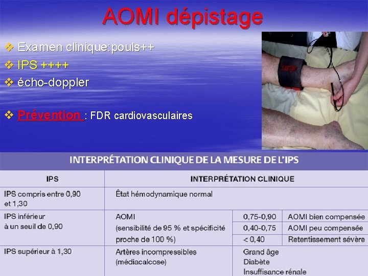 AOMI dépistage v Examen clinique: pouls++ v IPS ++++ v écho-doppler v Prévention :
