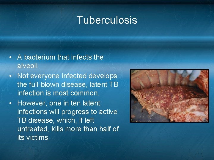 Tuberculosis • A bacterium that infects the alveoli • Not everyone infected develops the Tuberculosis • A bacterium that infects the alveoli • Not everyone infected develops the