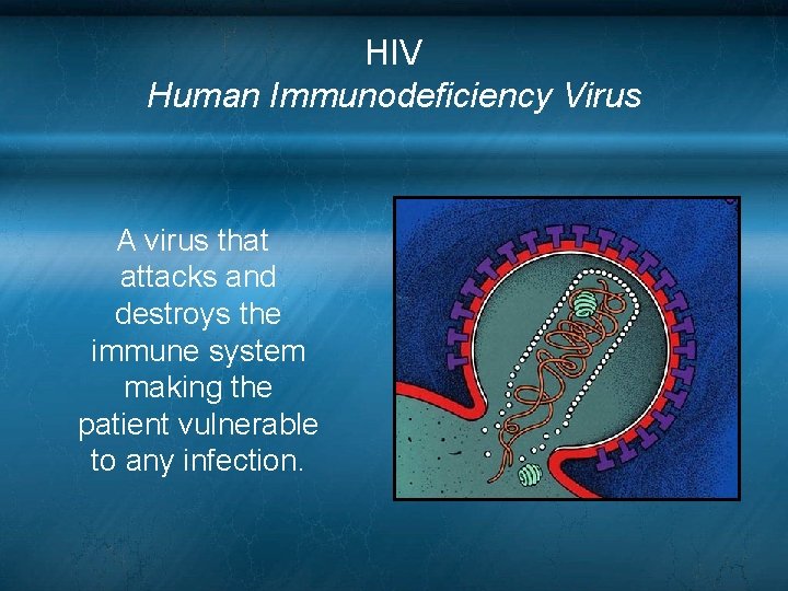 HIV Human Immunodeficiency Virus A virus that attacks and destroys the immune system making HIV Human Immunodeficiency Virus A virus that attacks and destroys the immune system making