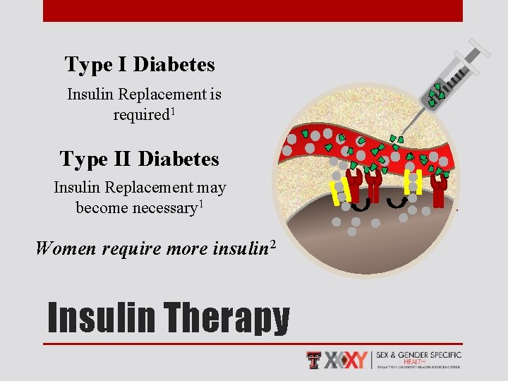 Type I Diabetes Insulin Replacement is required 1 Type II Diabetes Insulin Replacement may