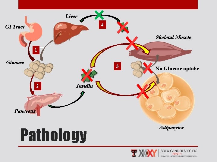 Liver 4 GI Tract Skeletal Muscle 1 Glucose 3 2 No Glucose uptake Insulin