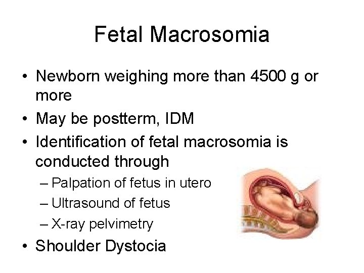 Fetal Macrosomia • Newborn weighing more than 4500 g or more • May be