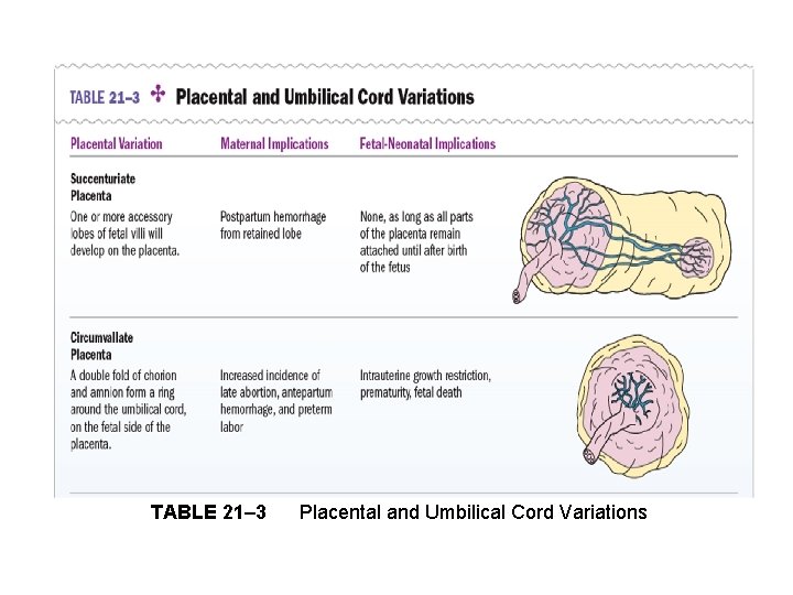 TABLE 21– 3 Placental and Umbilical Cord Variations 