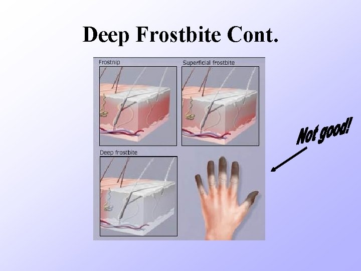 Deep Frostbite Cont. 